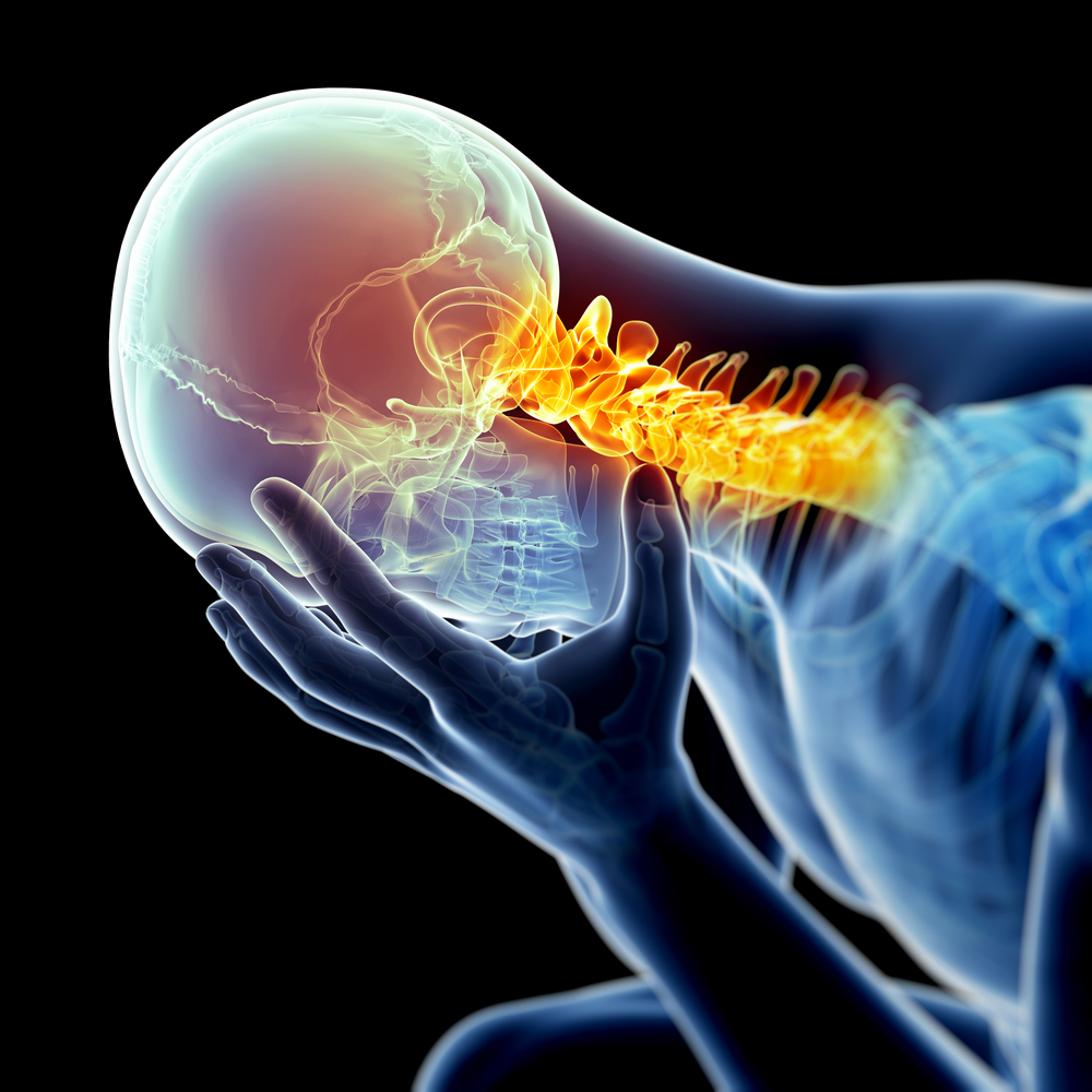Headache and Neck Pain: Are They Connected?